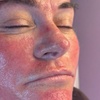Image 3: One or Three Microneedling Sessions with Skin Booster