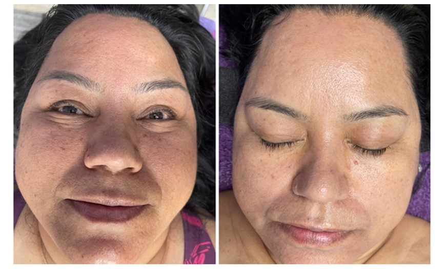 Image 9: Relax with Customized 60-Minute Advanced Facial of Choice One or Two!