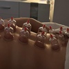 Image 3: Up to 39% Off on Massage & Cupping at Nice Brazilian Beauty