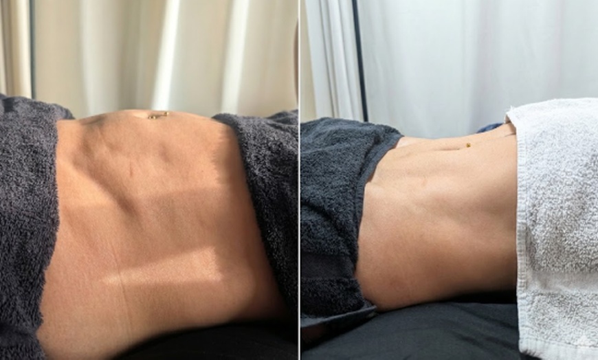 Image 2: 60-Min Post Op Lymphatic Massage: Boost Circulation & Reduce Swelling