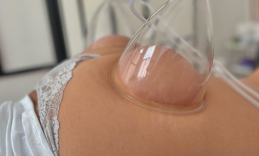 Image 3: ¡Consigue la piel firme que siempre has querido con unos tratamientos