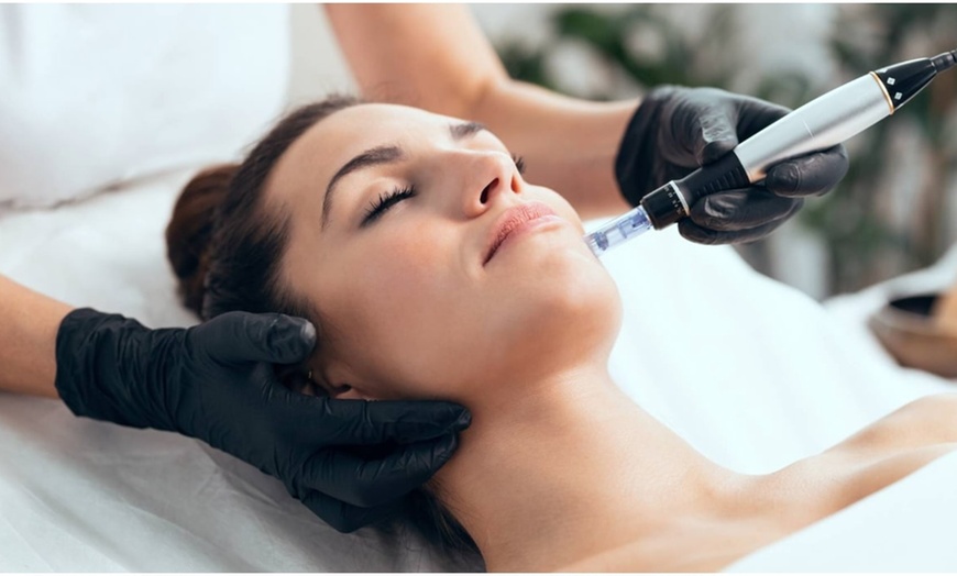 Image 3: Microneedling for Face & Neck or BB Glow Facial with Microneedling