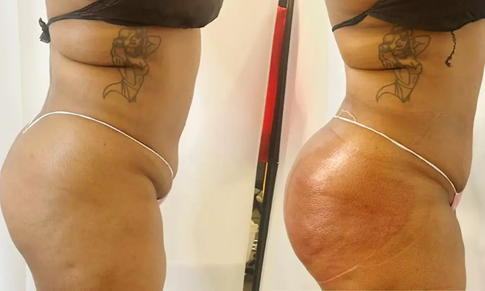 1 Infrared Detox Full Body Sauna Wrap or 3 Ionic Detox Foot Baths