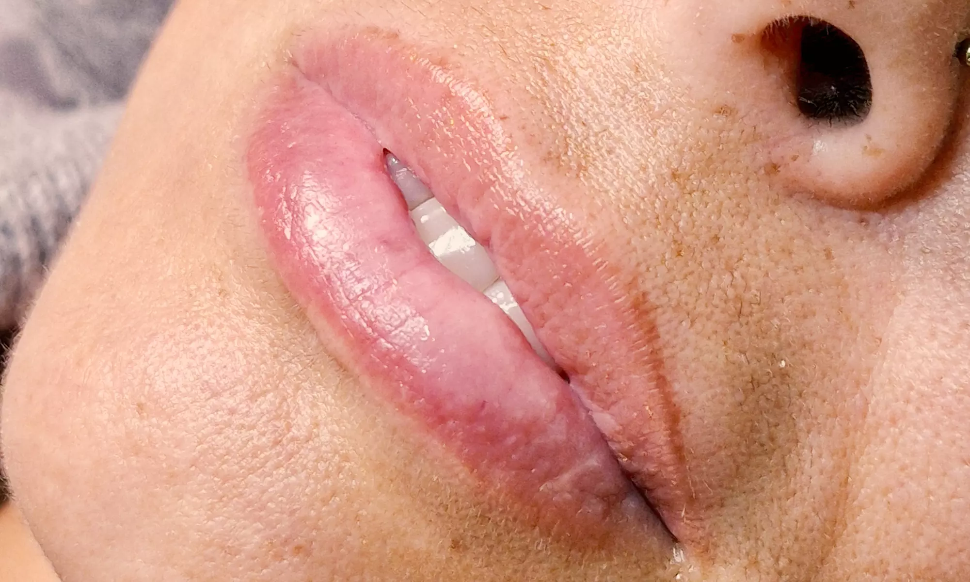 Revitalize Your Lips with Hydra Gloss Lips or Glossyps