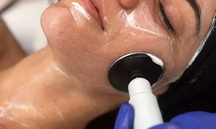 Tratamiento facial con radiofrecuencia y opción a presoterapia