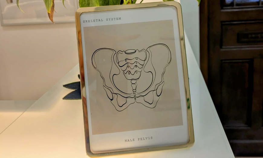 Image 3: 2 oder 3 EMP-Beckenboden-Trainings à 30 Min. inkl. Anamnesegespräch