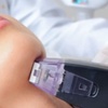 Image 2: Up to 90% Off Morpheus8 RF Microneedling 
