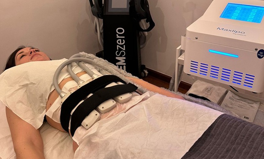 Image 2: Reduce la grasa con hasta 2 sesiones de criolipólisis y EMSculpt