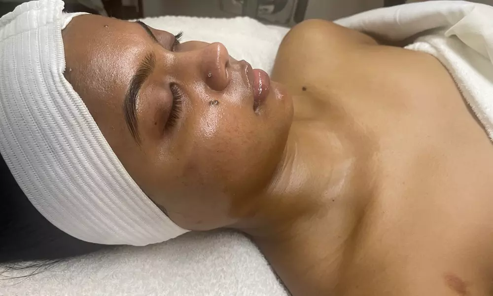 Glow Your Skin with One, Three or Five Oxygen Clarifying Facials at KP Aesthetics (Up to 73%Off) - Primary Image