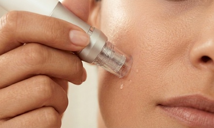 One Micro-Needling Treatment with deep Cleaning - ToxBar Med