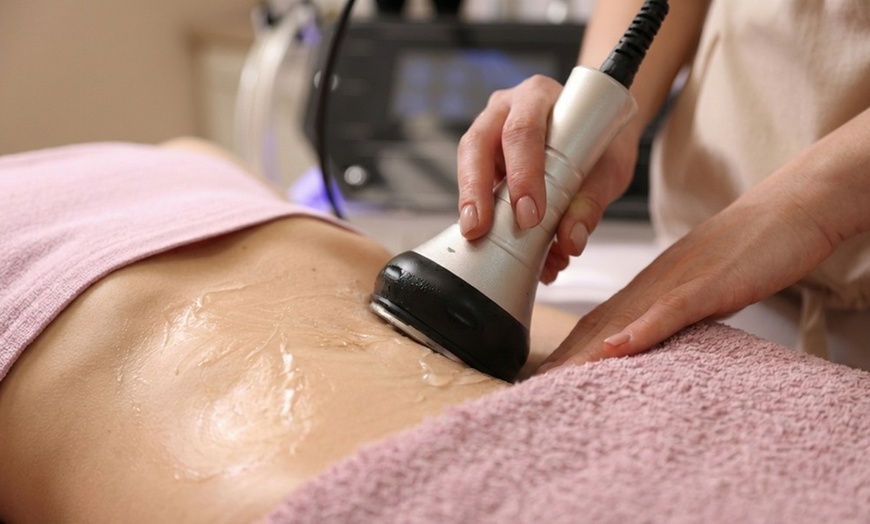 Image 2: Get Radio Frequency Treatment (1, 2 Small, or Large Areas )
