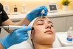 1, 2, or 3 Sessions of Skin Needling & Korean Exosomes for Skin or Hair at Facial Harmony By Bee (Up to 74% Off) - Image 3