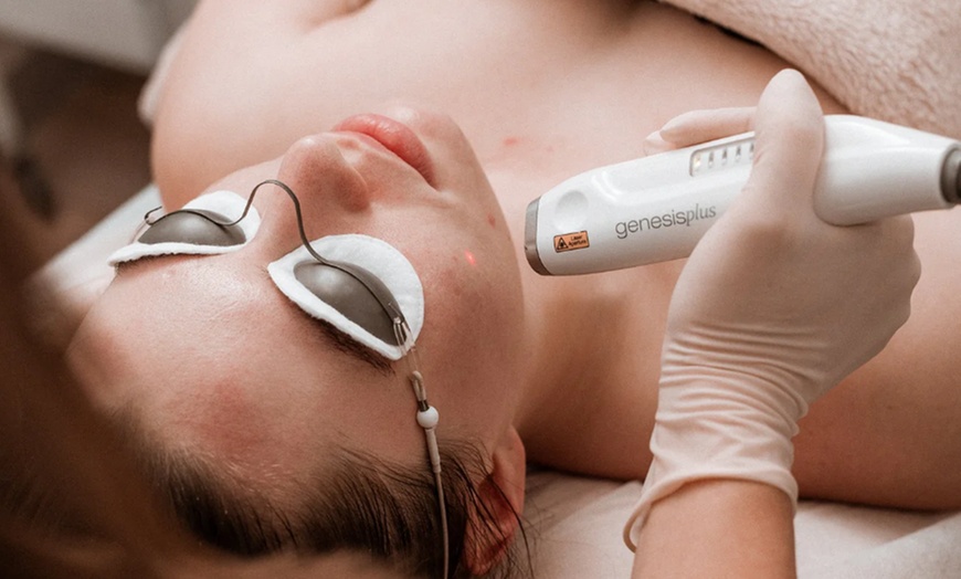 Image 1: Refresh Your Skin with Two or Three Laser Genesis Treatments