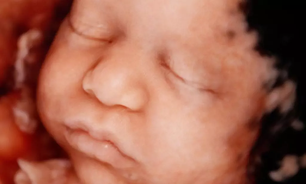 Tu bebé más cerca: ecografía 4D-5D emocional básica o plus