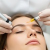 Image 1: Bio Filler Injections and PRP Facials for Natural-Looking Skin 