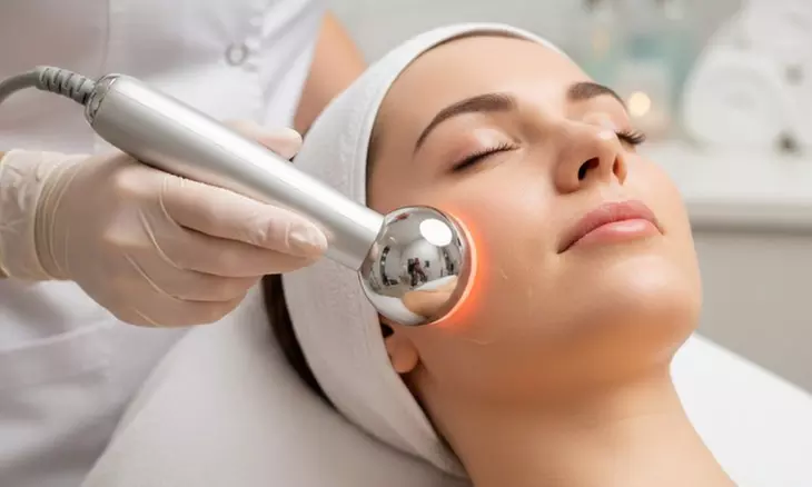 Limpieza facial con radiofrecuencia y microdermoabrasión o peeling