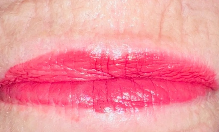 Image 1: Transform Your Skin: Microneedling with Cryo & Glutathione