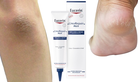 1 o 2 creme idratanti intensive Eucerin Urea repair plus 30% da 75 ml per aree della pelle molto secche e psoriasi
