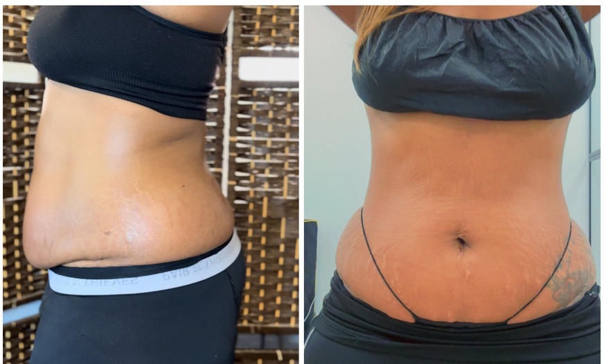 Image 2: Mini Body Sculpting Sessions: Intro, Try & Tone, or Reset
