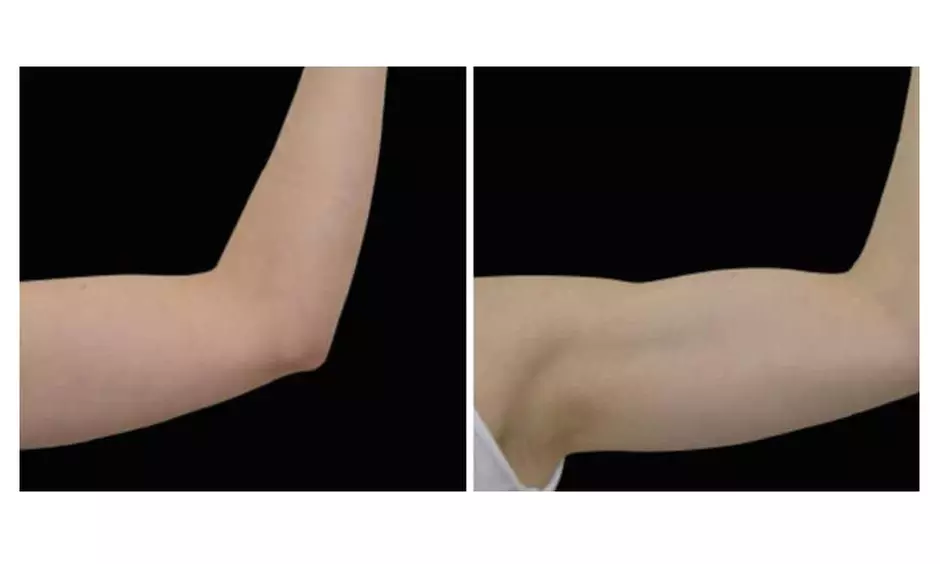 Achieve Sculpted Abs/ Buttocks/ Thighs in Just 30 Minutes