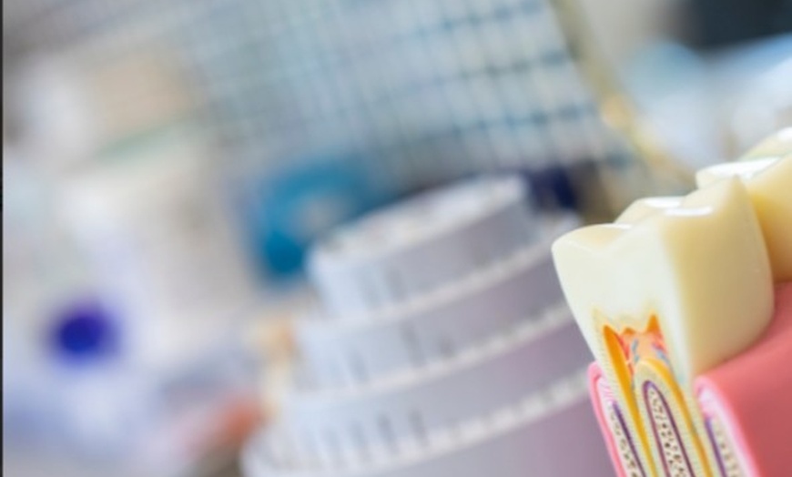 Image 7: Scale and Polish with a Choice of Laser Teeth Whitening at Denticare