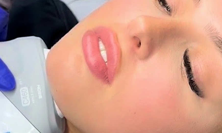 Image 5: Hydrabrasion Facial Treatment: 1 or 2 Sessions at JT Cosmetics (Up to 42% Off)