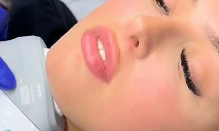 Hydrabrasion Facial Treatment: 1 or 2 Sessions at JT Cosmetics (Up to 42% Off)