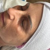 Image 1: 60 Min. Aqua Facial und/oder Microneedling für 1 Person