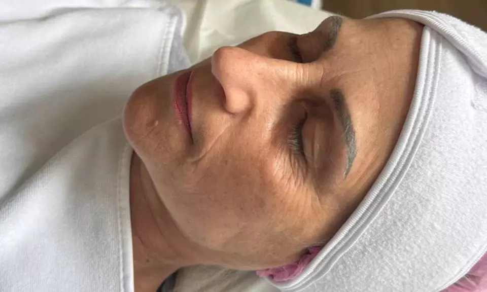 60 Min. Aqua Facial und/oder Microneedling für 1 Person (bis zu 42% sparen) - Primary Image