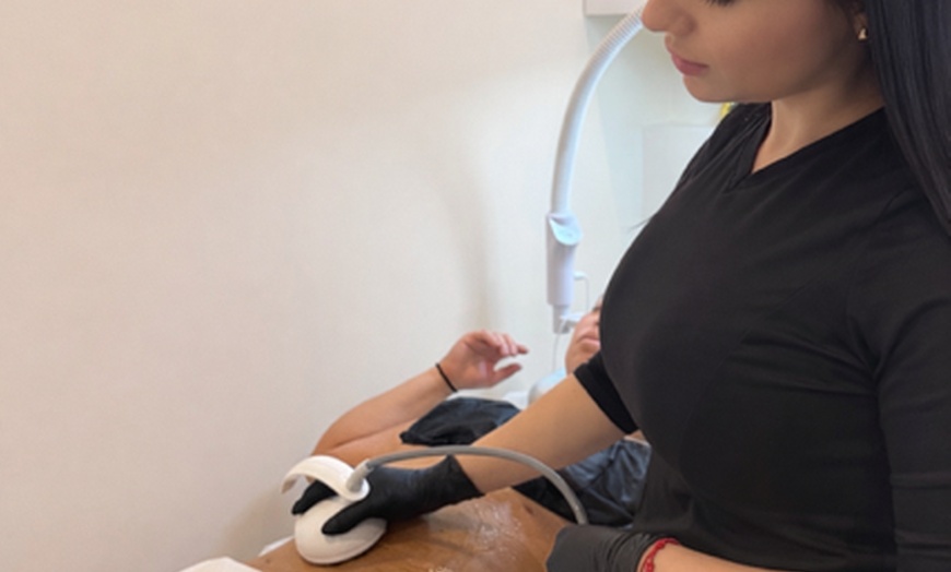 Image 3: 3 or 5 Sessions of Venus Legacy Luxury Radio Frequency Skin Tightening