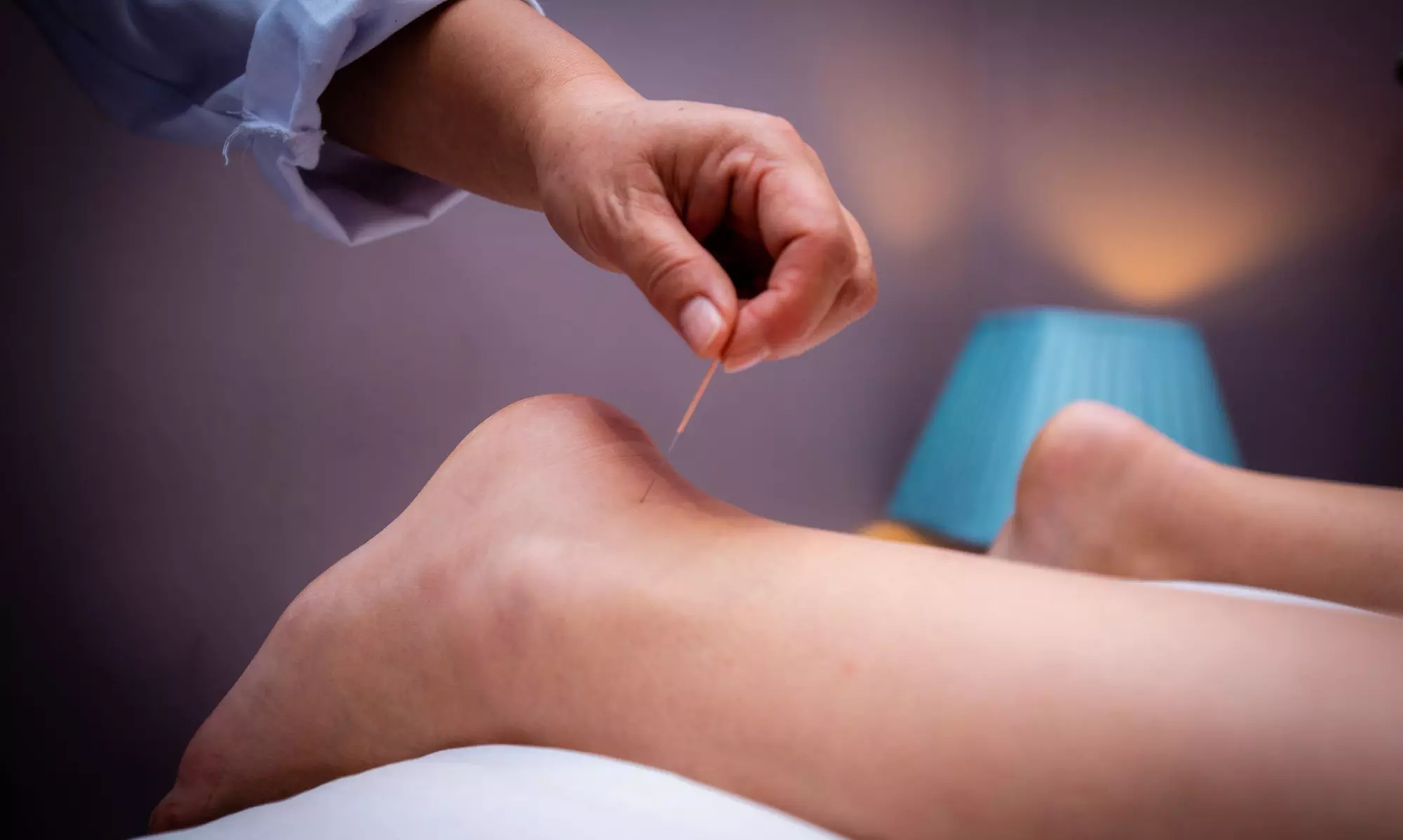 30 or 60-Minute Acupuncture or Choice of Massage with Optional Cupping