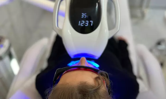 Strahlend weiße Zähne: 30 od. 60 Min. Zahn-Bleaching-Paket für 1 Pers.