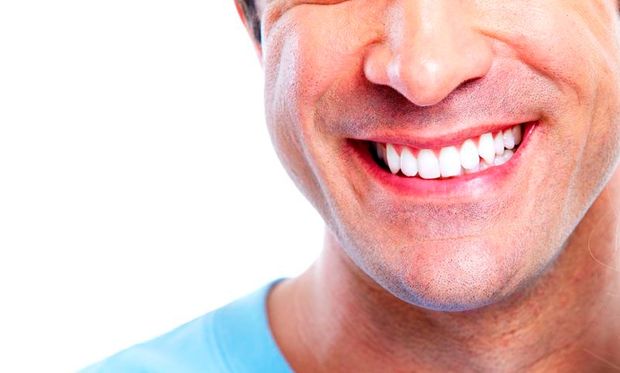 Image 1: Dental Examination with Hygienist, Airpolish & Optional Whitening Kit