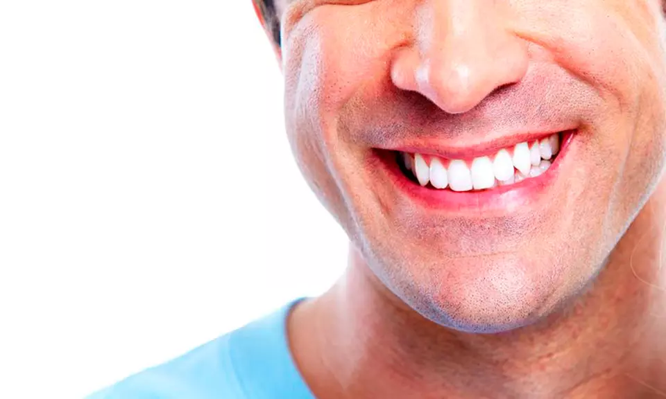 Dental Examination with Hygienist, Airpolish & Optional Whitening Kit