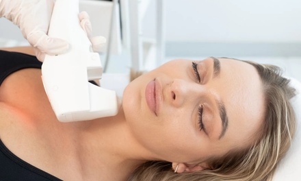 HIFU 3D: policzki, szyja lub czoło - Royal Hanza beauty studio