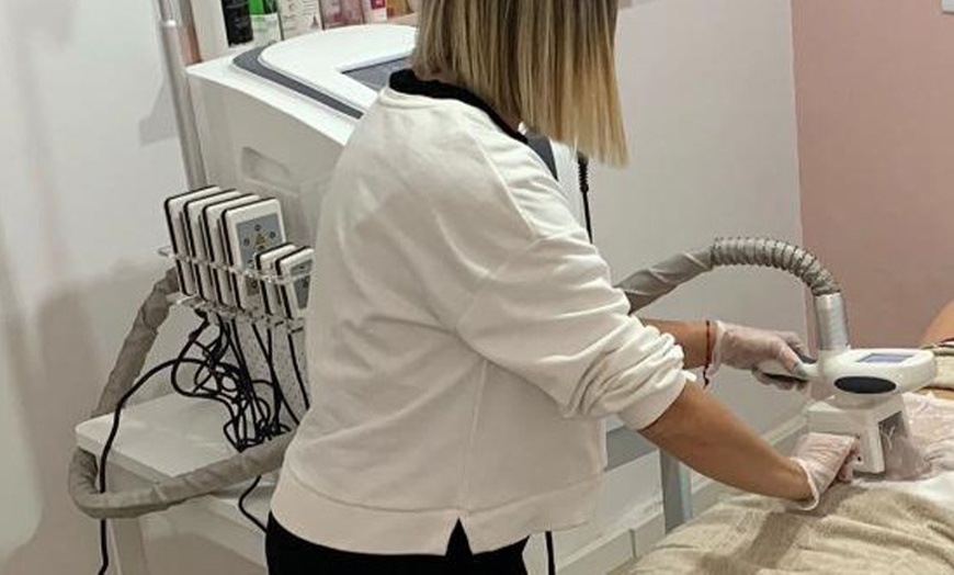 Image 2: Sesiones de presoterapia, con opción a criolipólisis, para 1 persona