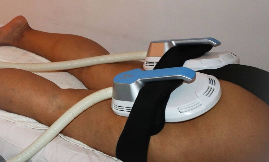 Image 3: Hasta 9 sesiones de electroestimulación y masaje drenante en Les Corts