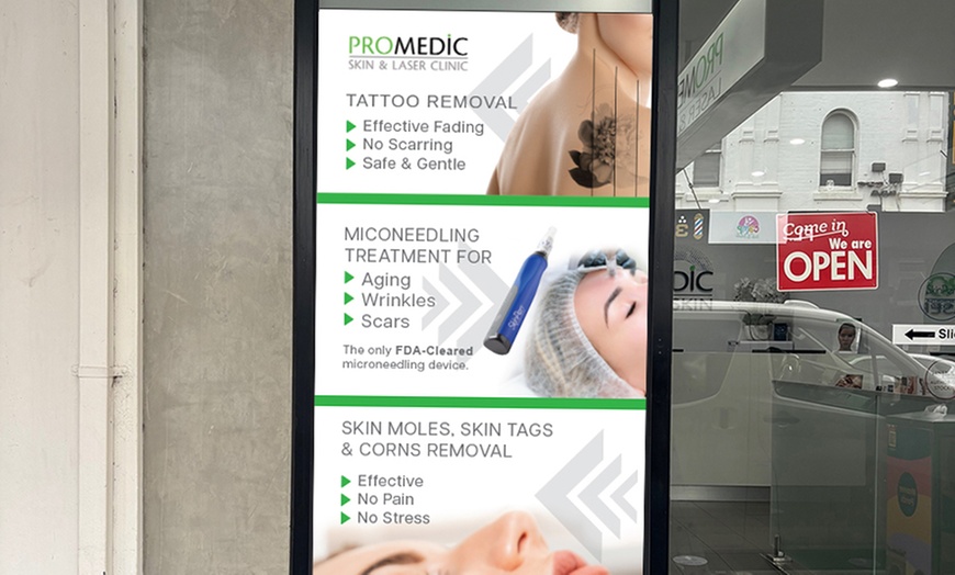 Image 3: Laser Tattoo Removal for Choice of Sizes by Expert Clinicians 