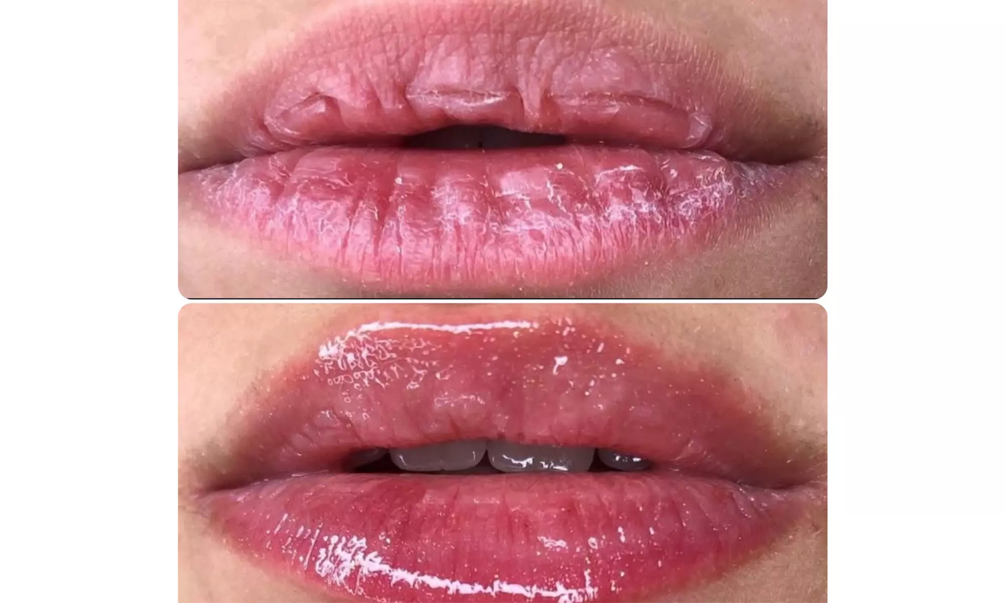 Lip Drip with optional Color Tint 
