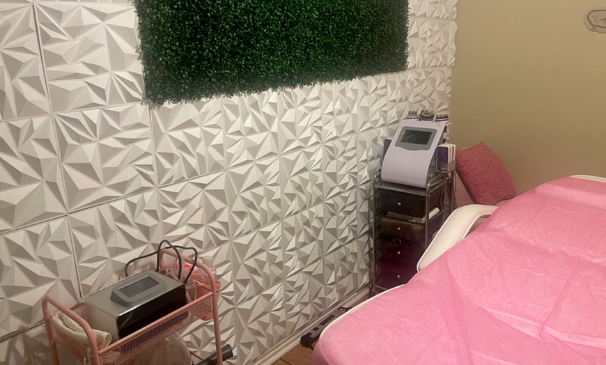 Image 3: Revitalize Your Look with RF Skin Tightening, Ultrasound Cavitation