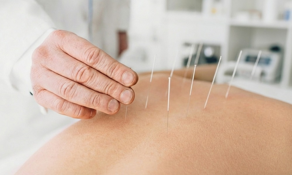 Get Acupuncture Treatment: A 90-Min Session/ 2 or 3 45-Min Sessions