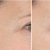 Image 3: LightStim Red Light Therapy Packages | Full Body Treatment
