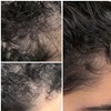 Image 9: Dermclar Method Hair Loss prevention and Neck Massage