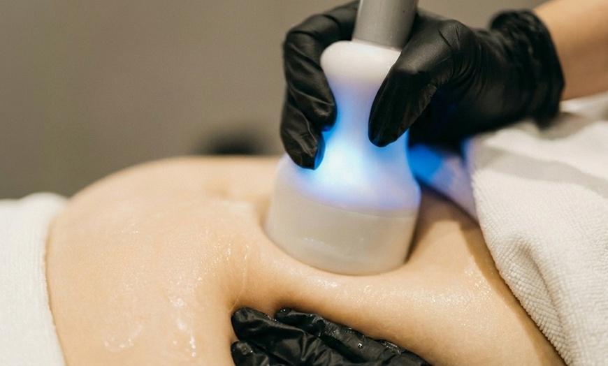 Image 3: Cryo T Shock Fat Freezing Options: 1–5 Sessions w/ Optional Endosphere