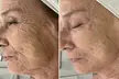 AdvaTx Laser in London Knightsbridge - Skin Rejuvenation For Pigmentation And More (Up to 41% Off) - Image 3
