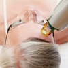 Image 3: Transform Your Skin With One or Three IPL Photo Facials