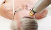 1 or 2 Radiofrequency Microneedling Skin Tightening & Rejuvenation at Dermacenter Medical Spa (Up to 72% Off)