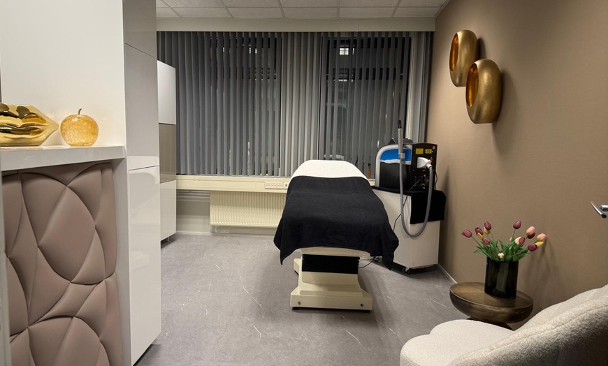 Image 1: Glow-up zonder filter: 1 of 3 carbon peeling behandelingen