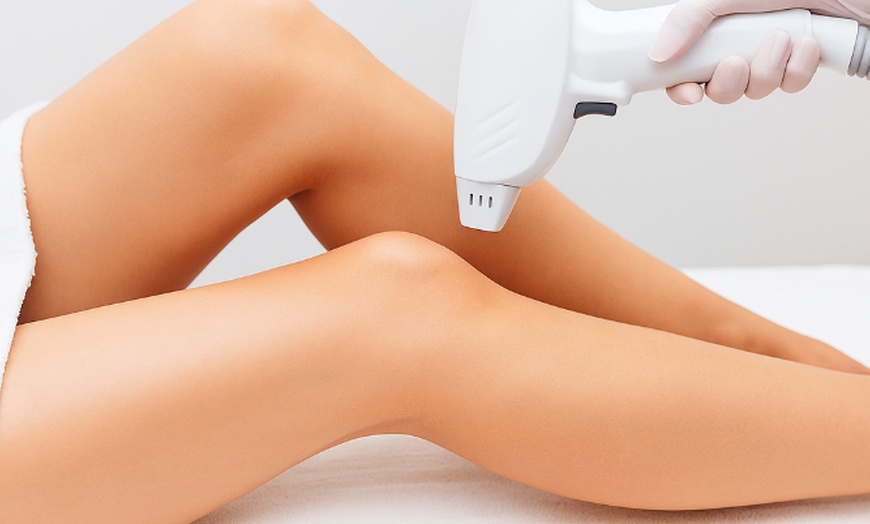 Image 2: Langanhaltende Haarentfernung mit dem Diode-Laser an 1 Zone