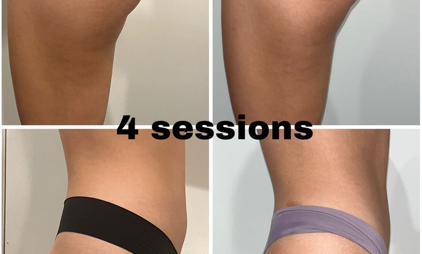 Image 5: Get Lifted with One, Two, or Three 40-Minute Non-Surgical Butt Lifts 